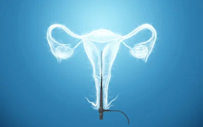All About Hysteroscopy—When & Why Hysteroscopy is Performed?