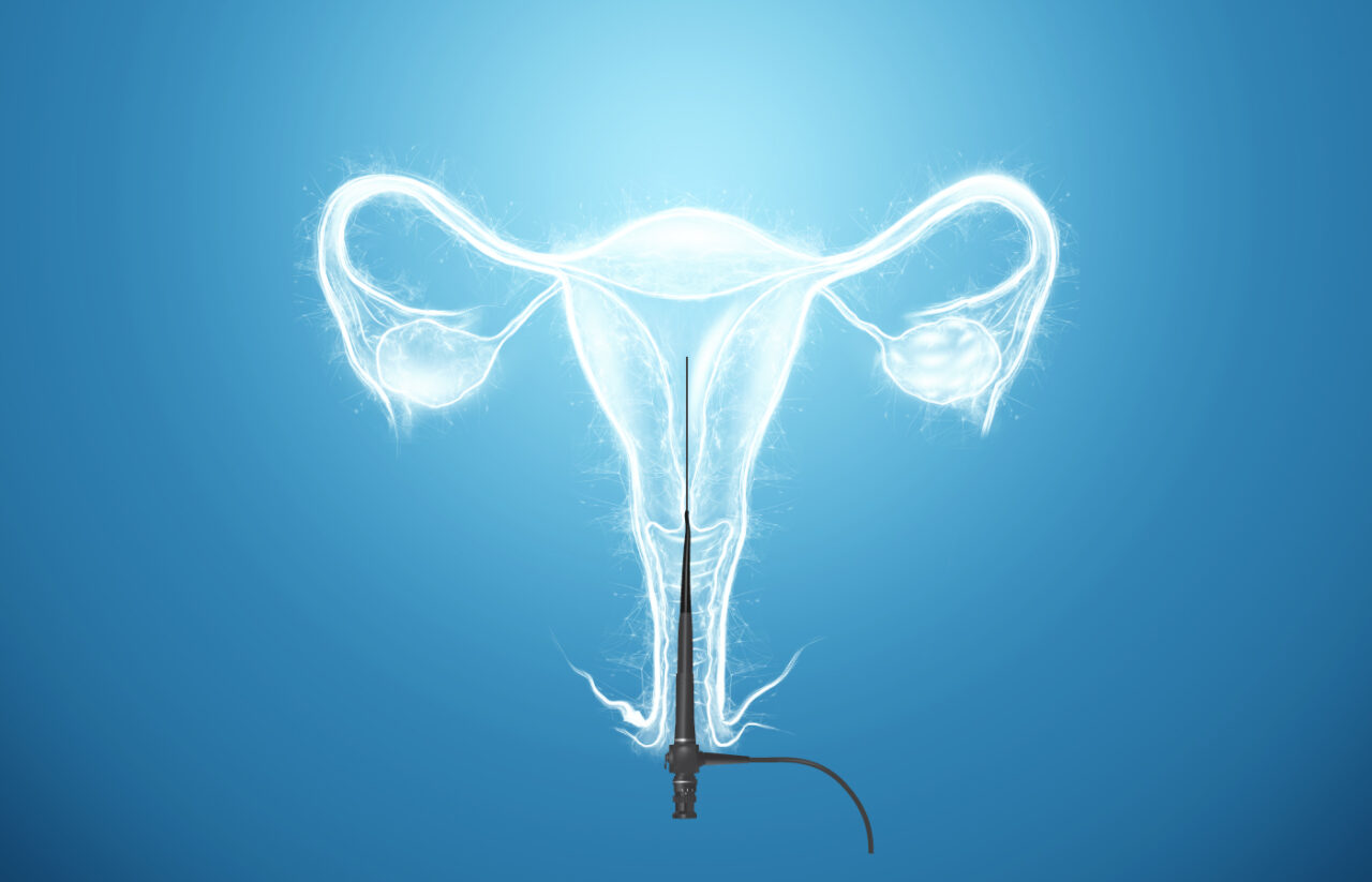 All About HysteroscopyWhen & Why Hysteroscopy is Performed? MotherToBe