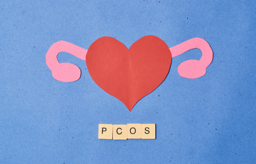 PCOS and Endometriosis: Can You Get Pregnant? Fertility Treatments & Expert Advice – MotherToBe