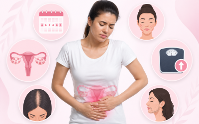 How to Know If You Have PCOS/PMOS: A Symptom Checklist